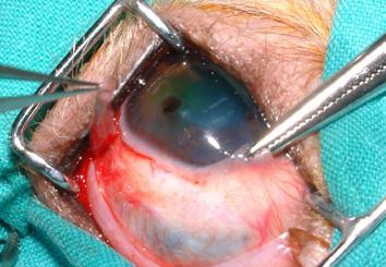 El tejido fibroso subyacente (cápsula de Tenon) debe separarse de la conjuntiva, de forma que ésta aparezca transparente. A continuación, se realizan dos cortes pa­ralelos para crear una tira de conjuntiva, que se rota para cubrir la lesión corneal. 