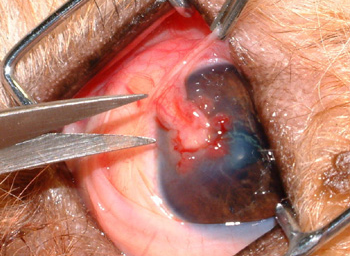 Los colgajos conjuntivales se adhieren al estroma corneal, pero no al epitelio adyacente que rodea la úlcera. El suministro de sangre puede interrumpirse, cortando la base del colgajo en el limbo, 3-8 semanas después de la colocación del colgajo.  