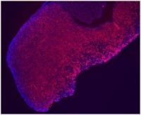 Hipófisis de ratón con las células somatotropas productoras de hormona del crecimiento teñidas de rojo